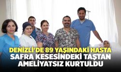 Denizli'de 89 Yaşındaki Hasta Safra Kesesindeki Taştan Ameliyatsız Kurtuldu