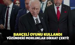 Bahçeli Oyunu Kullandı, Yüzündeki Morluklar Dikkat Çekti!