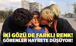 İki Gözü Farklı Renk! Görenler Hayrete Düşüyor