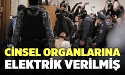 Cinsel Organlarına Elektrik Verilmiş