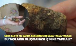 Genç Kız 10 Yıl Safra Kesesinde Devasa Taşla Yaşadı: Bu Taşların Oluşmaması İçin Ne Yapmalı?