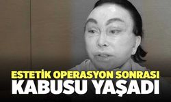 Estetik Operasyon Sonrası Kabusu Yaşadı