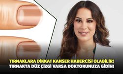 Tırnaklara Dikkat Kanser Habercisi Olabilir! Tırnakta Düz Çizgi Varsa Doktorunuza Gidin!