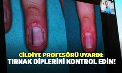 Cildiye Profesörü Uyardı: Tırnak Diplerini Kontrol Edin!