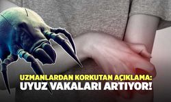 Uzmanlardan Korkutan Açıklama: Uyuz Vakaları Artıyor!